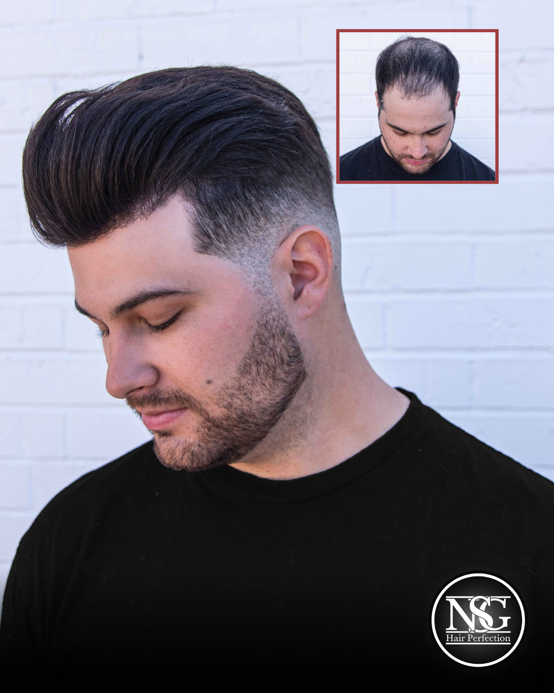 Hair replacement system